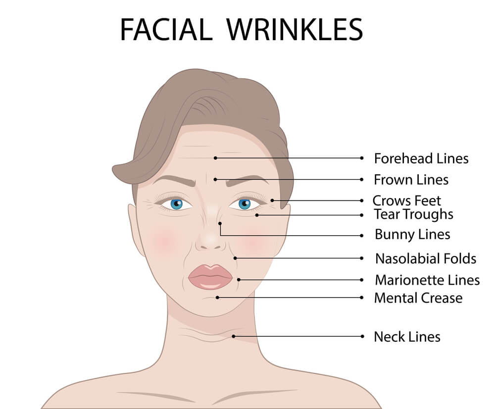 16 Popular Botox Injection Areas For Face And Neck Wrinkles Pharmacy